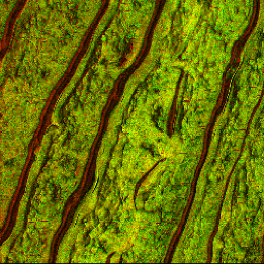 Visualization of Drug (Dexamethasone) in Human Skin Sample